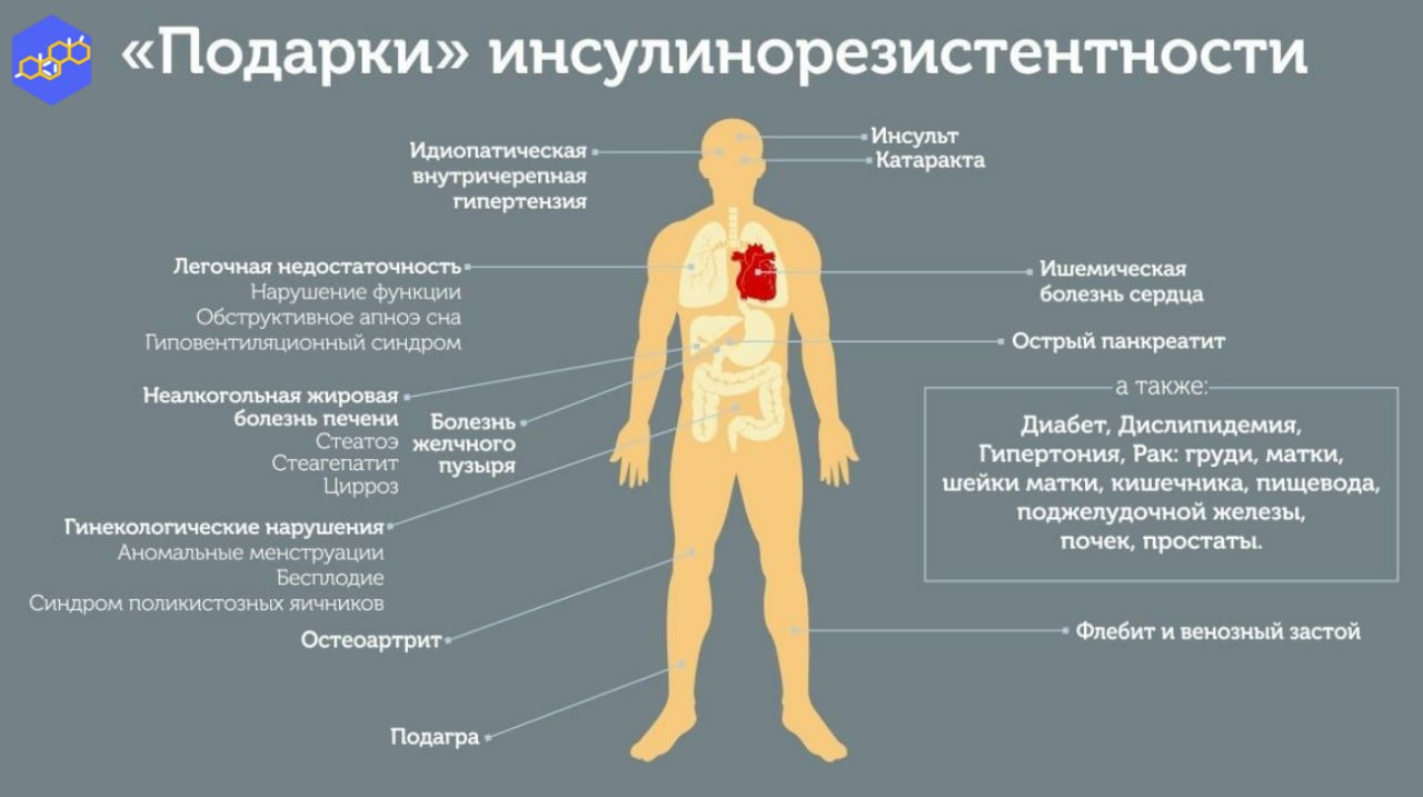 Причины заболевания мужчины. Признаки инсулина резистенции. Симптомы инсулин инсулинорезистентность. Инсулинорезистентность симп. Симптомы инсулинорезистентности у женщин.