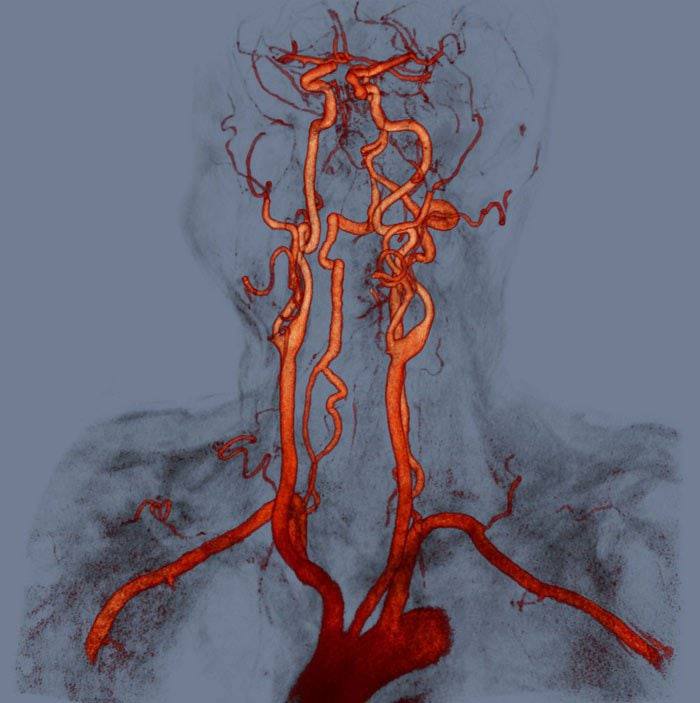мрт с контрастом и без. окб 1 тюмень аппарат мрт. мрт онкопоиск. томография головного мозга аппарат. кт и мрт клиника семейная на киевской.