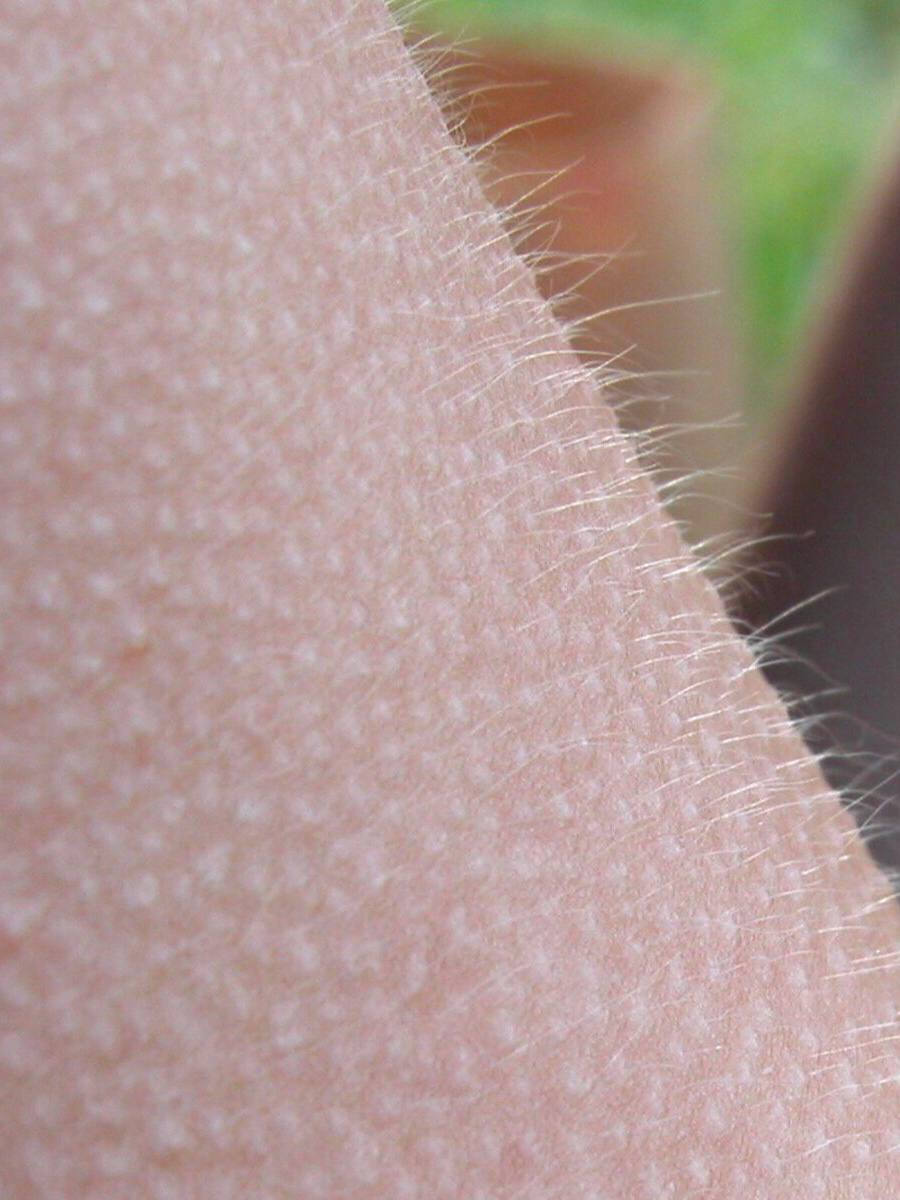 У меня уже мурашки. У меня уже мурашки. У меня уже мурашки. У меня уже мурашки. Причины мурашек по телу.